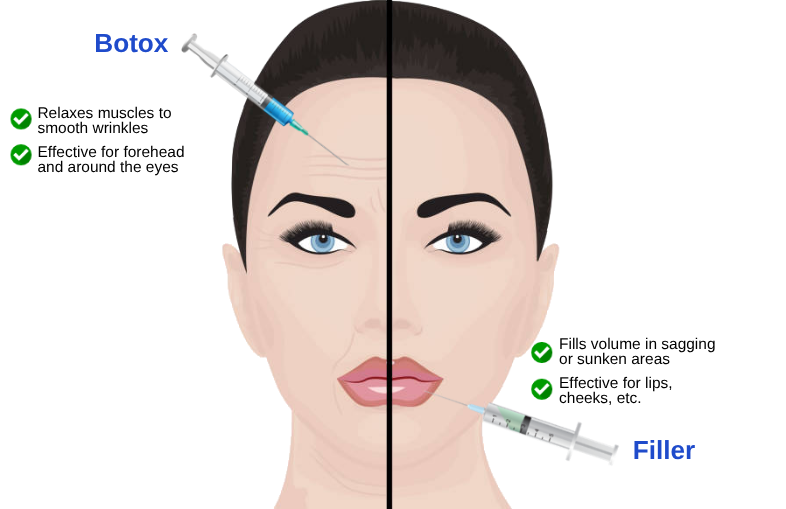filler in korea sh clinic gangnam seoul